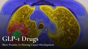 New Study Says GLP-1 Drugs May Help Slow Cancer Growth